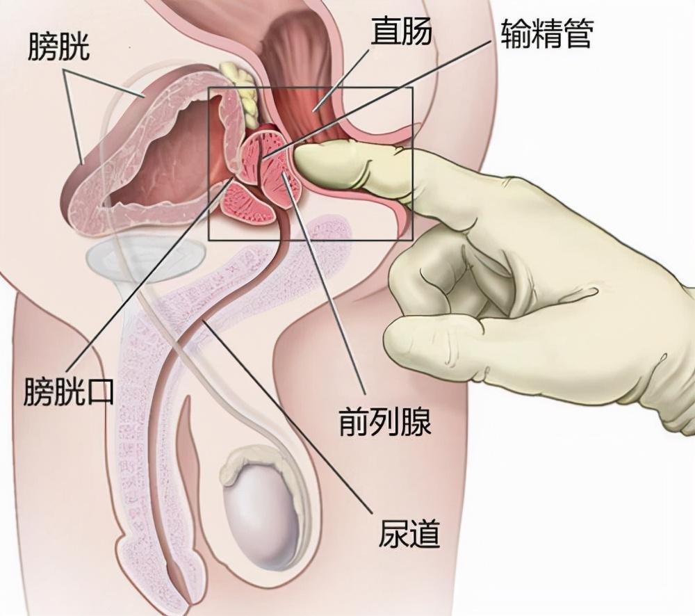 前列腺炎，重新認(rèn)識(shí)男性健康的誤區(qū)，重新認(rèn)識(shí)男性健康誤區(qū)，前列腺炎解析