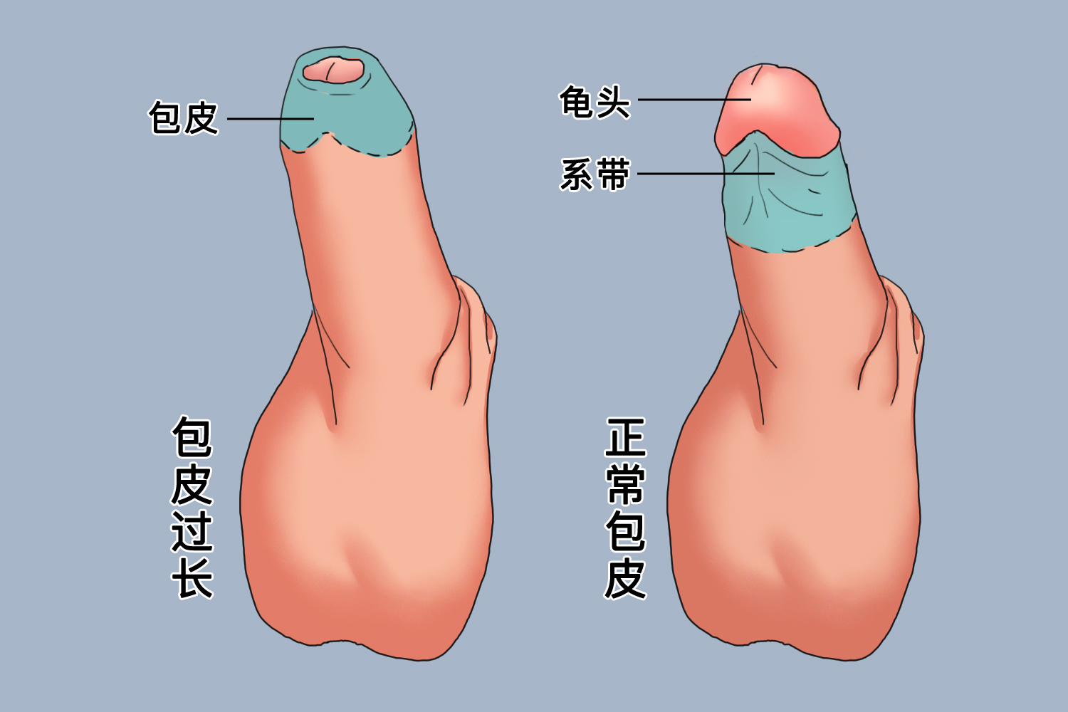 正常包皮的圖片及其相關(guān)知識(shí)科普，包皮圖片及其相關(guān)知識(shí)科普介紹