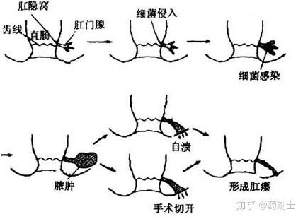 第445頁