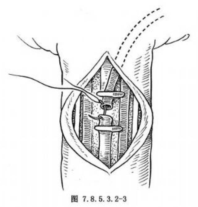 第494頁