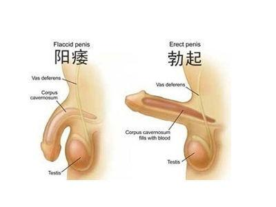 前列腺炎治療