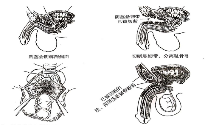 男性增大手術(shù)靠譜嗎？深度解析與探討，男性增大手術(shù)深度解析，可靠性與風(fēng)險探討